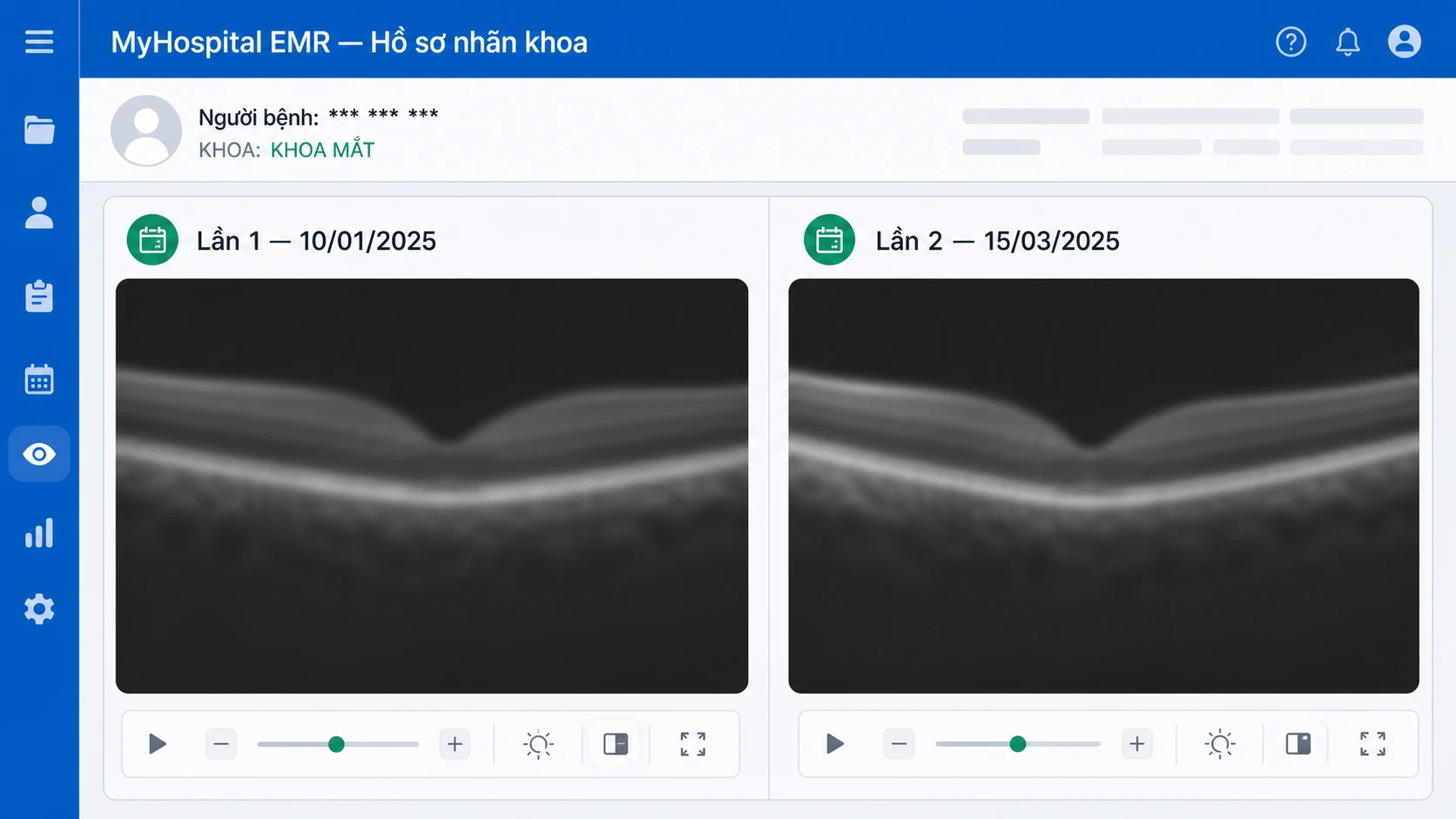 EMR MyHospital so sánh ảnh OCT đáy mắt DICOM hai lần khám