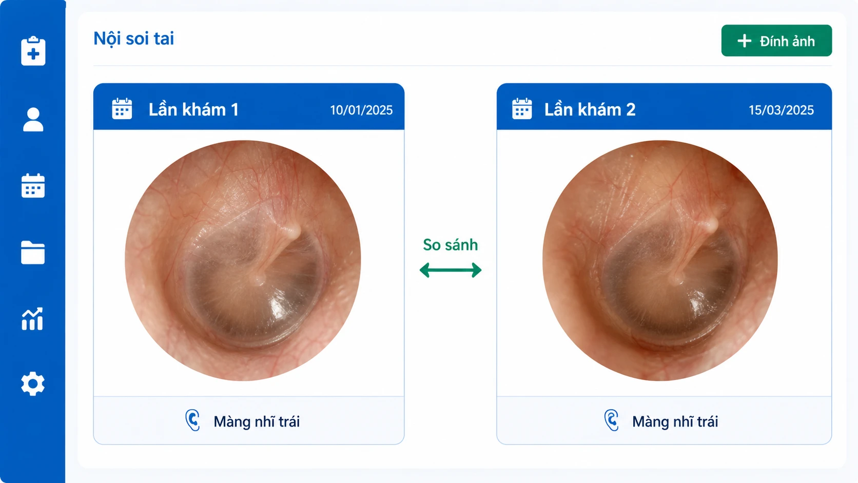 Module ảnh nội soi TMH so sánh lần khám 1 và lần khám 2