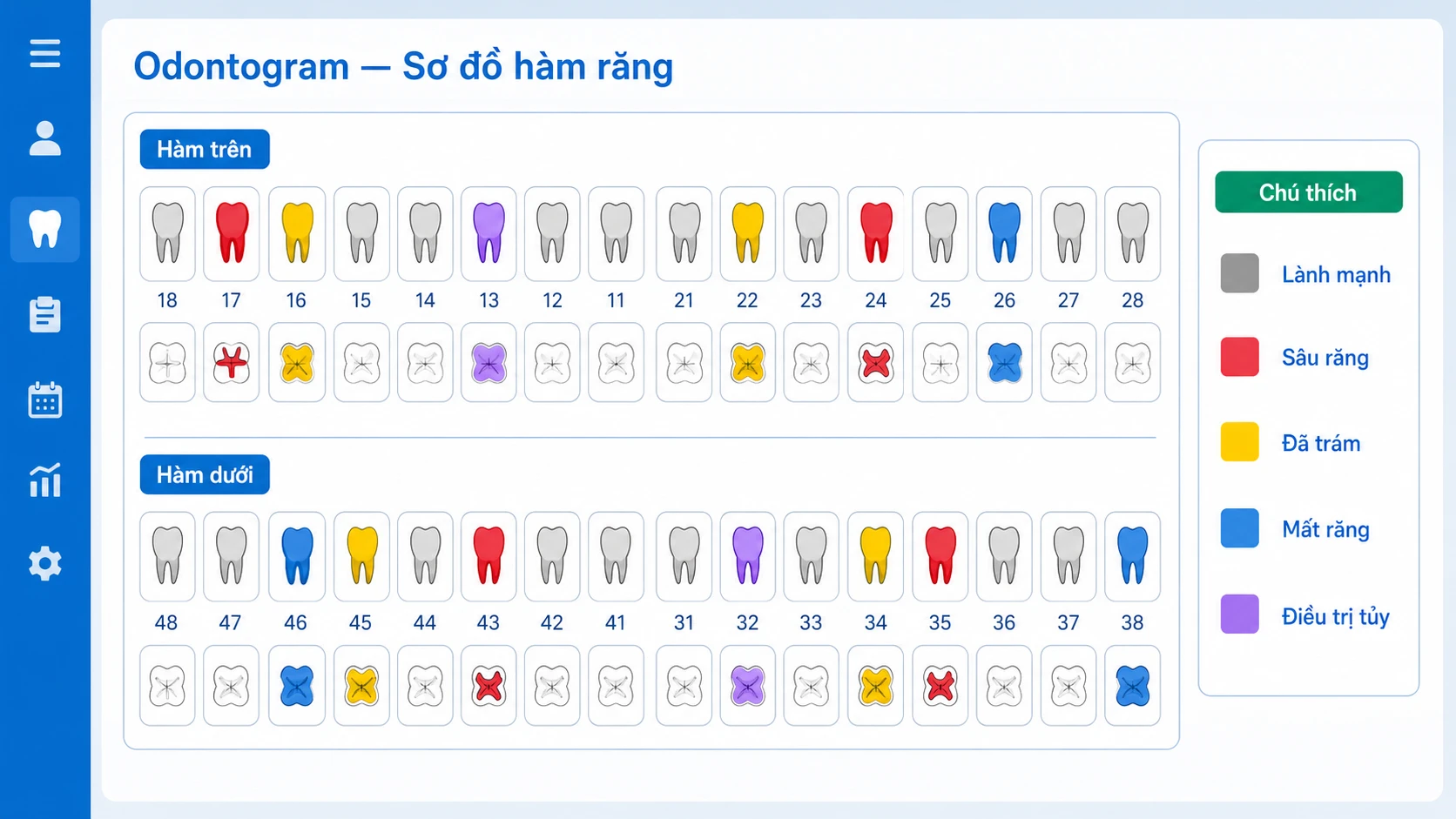 Odontogram tương tác 32 răng mã màu theo FDI trong EMR nha khoa
