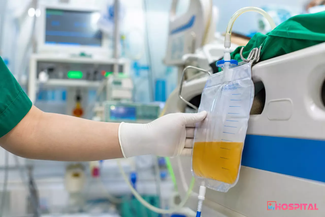 Điều dưỡng đọc thể tích nước tiểu trên túi đo có vạch chia gắn ở thành giường người bệnh
